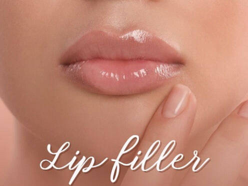 lip filler